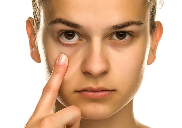 Borse sotto gli occhi e Occhiaie Cause e Rimedi Eucerin